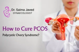 How to Cure PCOS: Polycystic Ovary Syndrome?