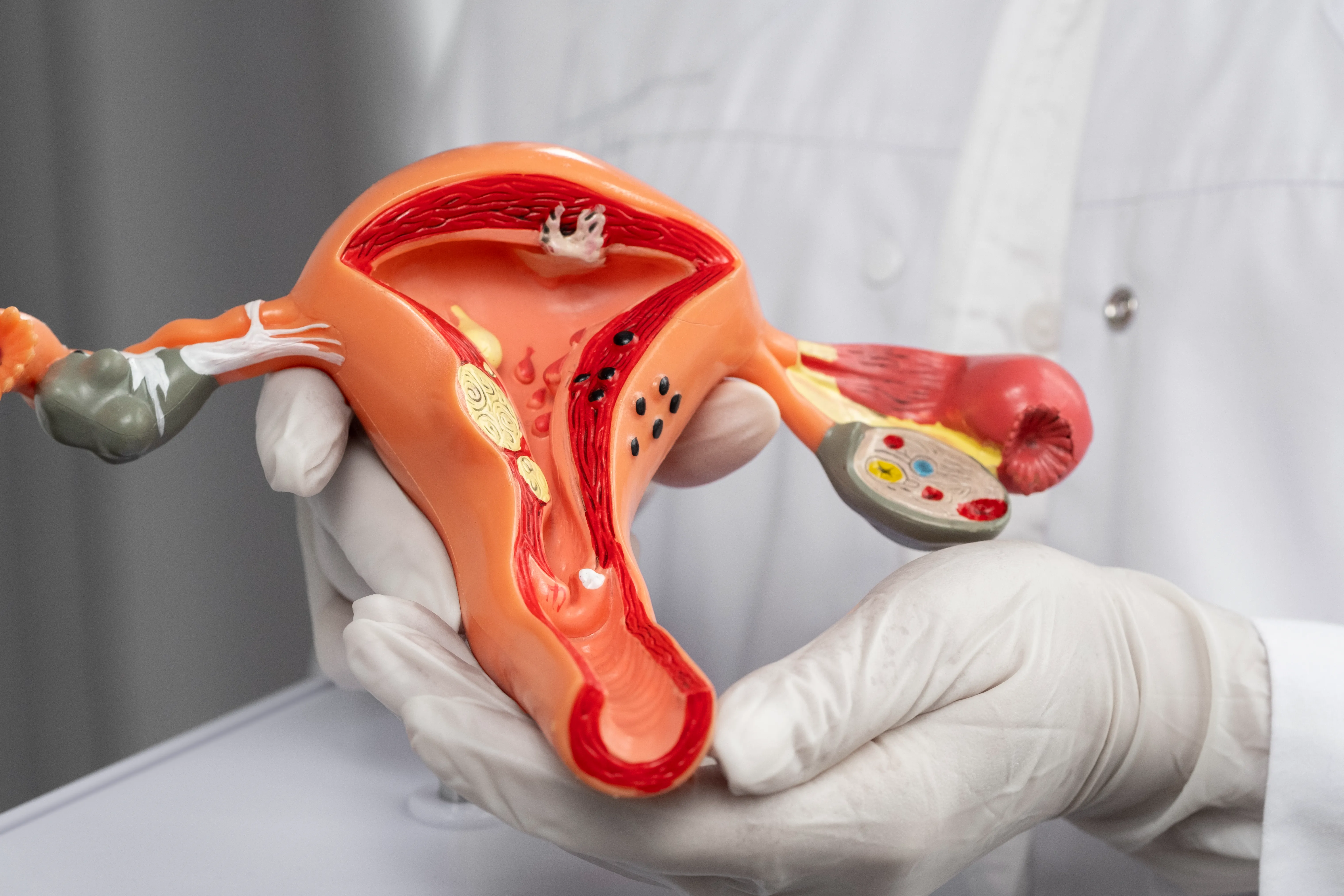best lady gynecologist in Kolkata, Fibroid Surgery Recovery Time